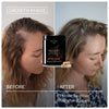 The Nue Co Growth Phase Hair Supplement