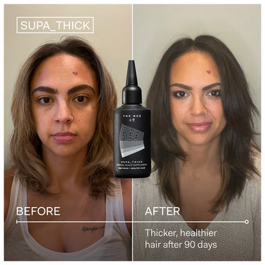 The Nue Co Supa Thick Scalp Treatment